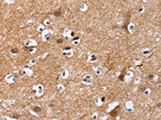 The image on the left is immunohistochemistry of paraffin-embedded Human brain tissue using CSB-PA133797(MAD1L1 Antibody) at dilution 1/25, on the right is treated with fusion protein. (Original magnification: ×200)