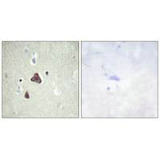 Immunohistochemistry analysis of paraffin-embedded human brain tissue, using ADCY8 antibody.