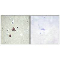 Immunohistochemistry analysis of paraffin-embedded human brain tissue, using ADCY8 antibody.
