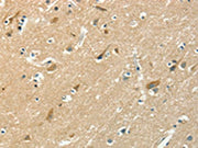 The image on the left is immunohistochemistry of paraffin-embedded Human brain tissue using CSB-PA133826(ASAH2 Antibody) at dilution 1/50, on the right is treated with fusion protein. (Original magnification: ×200)
