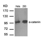 Western blot analysis of extracts from Hela and 293 cells using a-catenin(Ab-641) antibody.