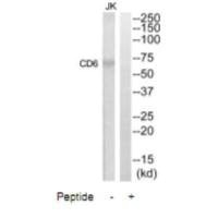 Western blot analysis of extracts from Jurkat cells, using CD6 antibody.
