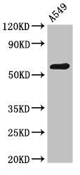 Western Blot Positive WB detected in: A549 whole cell lysate All lanes: PODXL antibody at 2.6µg/ml Secondary Goat polyclonal to rabbit IgG at 1/50000 dilution Predicted band size: 59, 56 kDa Observed band size: 59 kDa
