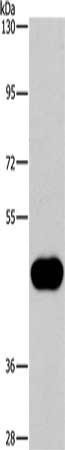 Gel: 6%SDS-PAGE, Lysate: 40 ug, Lane: Raji cells, Primary antibody: CSB-PA134528(CD38 Antibody) at dilution 1/260, Secondary antibody: Goat anti rabbit IgG at 1/8000 dilution, Exposure time: 3 minutes