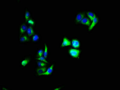 Immunofluorescence staining of Hela cells with CSB-PA13457A0Rb at 1:66, counter-stained with DAPI. The cells were fixed in 4% formaldehyde, permeabilized using 0.2% Triton X-100 and blocked in 10% normal Goat Serum. The cells were then incubated w...