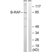 Western blot analysis of extracts from 293 cells, treated with insulin (0.01U/ml, 15mins), using B-RAF (Ab-446) antibody.