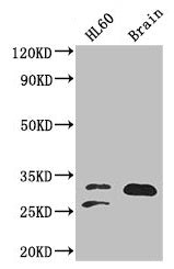 Western Blot Positive WB detected in: HL60 whole cell lysate, Mouse brain tissue All lanes: TPI1 antibody at 2µg/ml Secondary Goat polyclonal to rabbit IgG at 1/50000 dilution Predicted band size: 31, 27, 18 kDa Observed band size: 31, 27 kDa