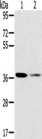 Gel: 8%SDS-PAGE, Lysate: 40 ug, Lane 1-2: 293T cells, Raji cells, Primary antibody: CSB-PA135133(SMN1 Antibody) at dilution 1/200, Secondary antibody: Goat anti rabbit IgG at 1/8000 dilution, Exposure time: 2 minutes