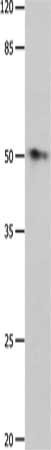 Gel: 10%SDS-PAGE, Lysate: 60 ug, Lane: Human liver cancer tissue, Primary antibody: CSB-PA135383(GFRA2 Antibody) at dilution 1/500, Secondary antibody: Goat anti rabbit IgG at 1/8000 dilution, Exposure time: 1 minute