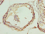 Immunohistochemistry of paraffin-embedded human testis tissue using CSB-PA13569A0Rb at dilution of 1:100