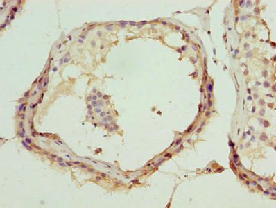 Immunohistochemistry of paraffin-embedded human testis tissue using CSB-PA13569A0Rb at dilution of 1:100