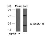 Western blot analysis of extracts from mouse brain tissue using Tau(Phospho-Ser214) Antibody and the same antibody preincubated with blocking peptide.