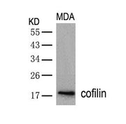 Western blot analysis of extracts from MDA cells using cofilin(Ab-3) Antibody.