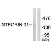 Western blot analysis of extracts from Jurkat cells, using Integrin β1 (Ab-789) antibody.