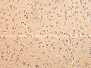 The image on the left is immunohistochemistry of paraffin-embedded Human brain tissue using CSB-PA136284(ATIC Antibody) at dilution 1/25, on the right is treated with fusion protein. (Original magnification: ×200)