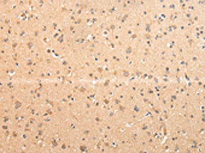 The image on the left is immunohistochemistry of paraffin-embedded Human brain tissue using CSB-PA136284(ATIC Antibody) at dilution 1/25, on the right is treated with fusion protein. (Original magnification: ×200)