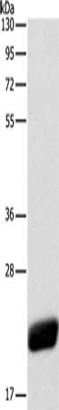 Gel: 10%SDS-PAGE, Lysate: 40 ug, Lane: Human leiomyosarcoma tissue, Primary antibody: CSB-PA136745(CAV1 Antibody) at dilution 1/525, Secondary antibody: Goat anti rabbit IgG at 1/8000 dilution, Exposure time: 40 seconds