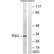 Western blot analysis of extracts from HepG2 cells, using RPS3 antibody.