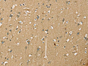The image on the left is immunohistochemistry of paraffin-embedded Human brain tissue using CSB-PA137248(NES Antibody) at dilution 1/35, on the right is treated with synthetic peptide. (Original magnification: ×200)