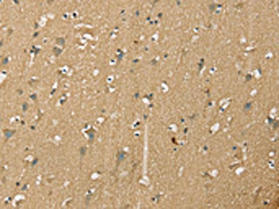 The image on the left is immunohistochemistry of paraffin-embedded Human brain tissue using CSB-PA137248(NES Antibody) at dilution 1/35, on the right is treated with synthetic peptide. (Original magnification: ×200)