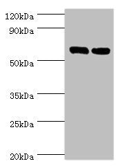 Western blot All lanes: TROVE2 antibody at 2µg/ml Lane 1: Hela whole cell lysate Lane 2: 293T whole cell lysate Secondary Goat polyclonal to rabbit IgG at 1/10000 dilution Predicted band size: 61, 24, 59, 60 kDa Observed band size: 61 kDa