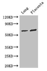 Western Blot Positive WB detected in: Mouse lung tissue, Human placenta tissue All lanes: STAU1 antibody at 3ug/ml Secondary Goat polyclonal to rabbit IgG at 1/50000 dilution Predicted band size: 64, 55, 56 kDa Observed band size: 64 kDa