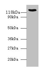 Western blot All lanes: VCL antibody at 2µg/ml + 293T whole cell lysate Secondary Goat polyclonal to rabbit IgG at 1/10000 dilution Predicted band size: 124, 117, 25 kDa Observed band size: 124 kDa