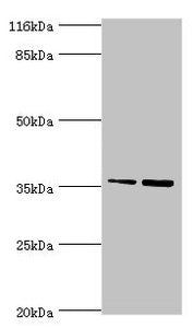 Western blot All lanes: CFHR2 antibody at 2µg/ml Lane 1: Hela whole cell lysate Lane 2: 293T whole cell lysate Secondary Goat polyclonal to rabbit IgG at 1/10000 dilution Predicted band size: 31, 28 kDa Observed band size: 36 kDa