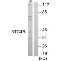 Western blot analysis of extracts from Jurkat cells, using ATG4B antibody.
