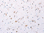 The image on the left is immunohistochemistry of paraffin-embedded Human brain tissue using CSB-PA138502(CCKAR Antibody) at dilution 1/20, on the right is treated with synthetic peptide. (Original magnification: ×200)