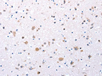 The image on the left is immunohistochemistry of paraffin-embedded Human brain tissue using CSB-PA138502(CCKAR Antibody) at dilution 1/20, on the right is treated with synthetic peptide. (Original magnification: ×200)