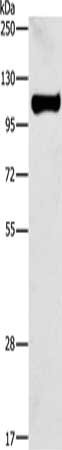 Gel: 8%SDS-PAGE, Lysate: 40 ug, Lane: Raji cells, Primary antibody: CSB-PA138665(STAT6 Antibody) at dilution 1/450, Secondary antibody: Goat anti rabbit IgG at 1/8000 dilution, Exposure time: 5 seconds