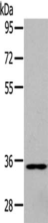 Gel: 10%SDS-PAGE, Lysate: 30 ug, Lane: Human fetal brain tissue, Primary antibody: CSB-PA138694(GJD2 Antibody) at dilution 1/250, Secondary antibody: Goat anti rabbit IgG at 1/8000 dilution, Exposure time: 5 minutes