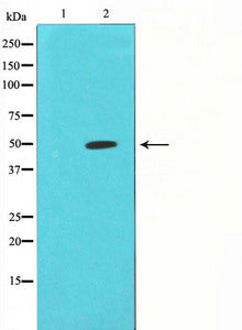 Western blot analysis on K562 cell lysate using Fos antibody,The lane on the left is treated with the antigen-specific peptide.