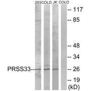 Western blot analysis of extracts from 293 cells, COLO cells and Jurkat cells, using PRSS33 antibody.
