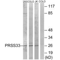 Western blot analysis of extracts from 293 cells, COLO cells and Jurkat cells, using PRSS33 antibody.