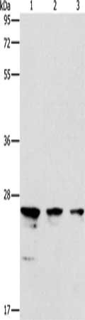 Gel: 12%SDS-PAGE, Lysate: 40 ug, Lane 1-3: Jurkat cells, K562 cells, mouse testis tissue, Primary antibody: CSB-PA139000(MOB1B Antibody) at dilution 1/225, Secondary antibody: Goat anti rabbit IgG at 1/8000 dilution, Exposure time: 1 minute