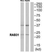 Western blot analysis of extracts from HeLa cells and HepG2 cells, using RAB31 antibody.