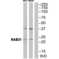Western blot analysis of extracts from HeLa cells and HepG2 cells, using RAB31 antibody.