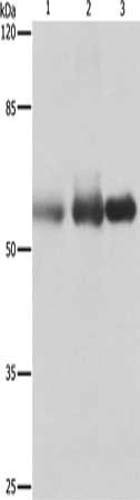Gel: 10%SDS-PAGE, Lysate: 30 ug, Lane 1-3: Human cervical cancer tissue, Human legs fibrous histiocytoma, Human fetal brain tissue, Primary antibody: CSB-PA139246(PVRL1 Antibody) at dilution 1/400, Secondary antibody: Goat anti rabbit IgG at 1/800...