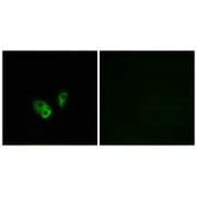 Immunofluorescence analysis of A549 cells, using CNGA2 antibody.