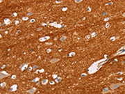 The image on the left is immunohistochemistry of paraffin-embedded Human brain tissue using CSB-PA139477(IGSF8 Antibody) at dilution 1/15, on the right is treated with fusion protein. (Original magnification: ×200)