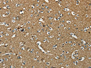 The image on the left is immunohistochemistry of paraffin-embedded Human brain tissue using CSB-PA139497(NEMF Antibody) at dilution 1/30, on the right is treated with synthetic peptide. (Original magnification: ×200)