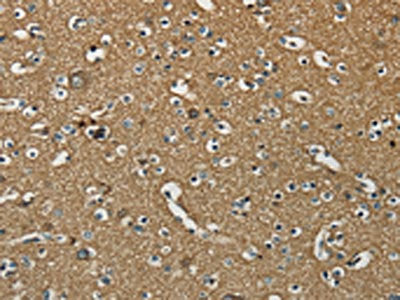 The image on the left is immunohistochemistry of paraffin-embedded Human brain tissue using CSB-PA139497(NEMF Antibody) at dilution 1/30, on the right is treated with synthetic peptide. (Original magnification: ×200)