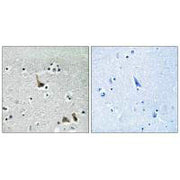 Immunohistochemistry analysis of paraffin-embedded human brain tissue using ATP6V1H antibody.
