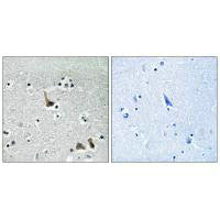 Immunohistochemistry analysis of paraffin-embedded human brain tissue using ATP6V1H antibody.