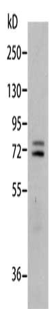 Gel: 10%SDS-PAGE, Lysate: 40 ug, Lane: Mouse liver tissue, Primary antibody: CSB-PA139729(MMP2 Antibody) at dilution 1/500, Secondary antibody: Goat anti rabbit IgG at 1/8000 dilution, Exposure time: 20 seconds