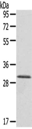 Gel: 8%SDS-PAGE,Lysate: 40 ug,,Primary antibody: CSB-PA139877(HTATIP2 Antibody) at dilution 1/800 dilution,Secondary antibody: Goat anti rabbit IgG at 1/8000 dilution,Exposure time: 5 seconds