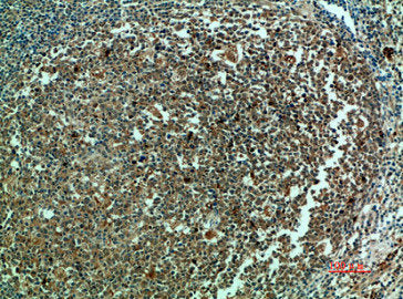 Immunohistochemical analysis of paraffin-embedded human-tonsils, antibody was diluted at 1:200
