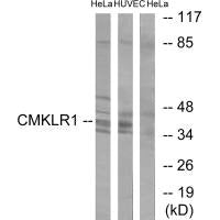 Western blot analysis of extracts from HepG2 cells, HeLa cells and 293 cells, using CMKLR1 antibody.